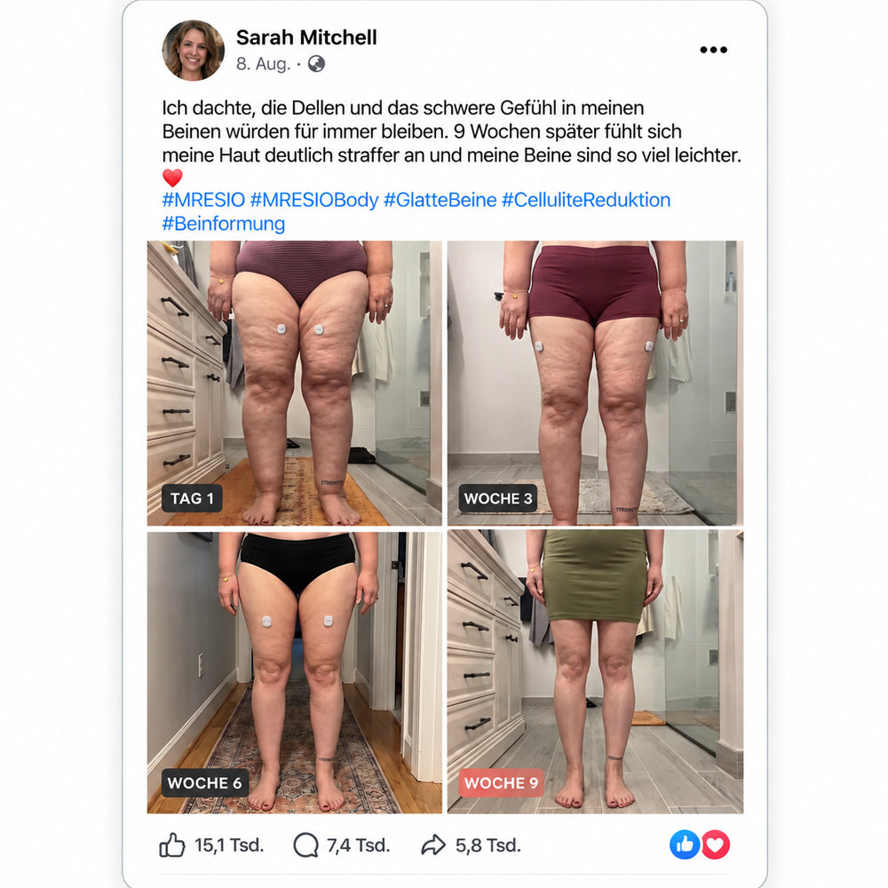 🔥  Mresio® ✨ Mikro-RF Körperkonturierung & Lymphdrainage-Gerät 🪴