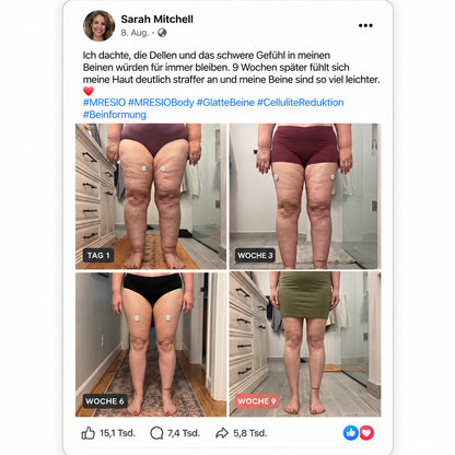 🔥  Mresio® ✨ Mikro-RF Körperkonturierung & Lymphdrainage-Gerät 🪴