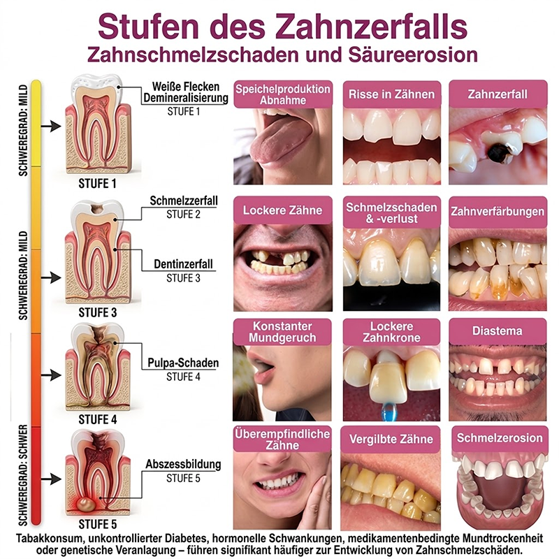 Purelora® DenPerm – Natürliches Zahnschmelz-Füllgel zur Kariesreparatur