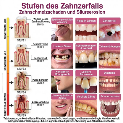 Purelora® DenPerm – Natürliches Zahnschmelz-Füllgel zur Kariesreparatur